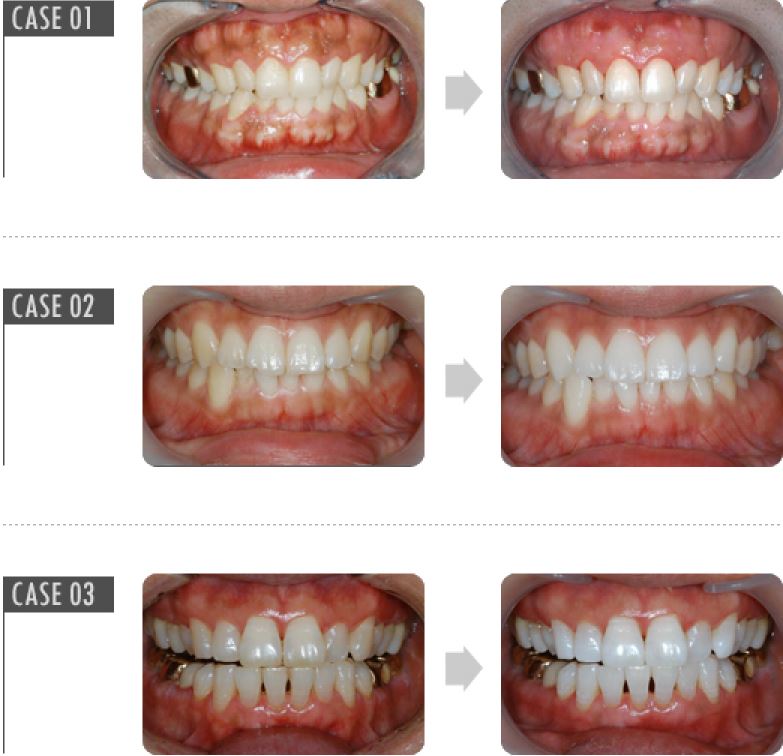 20200306_090839_5e6194873665b.jpg 20200306_090839_5e6194873665b.jpg