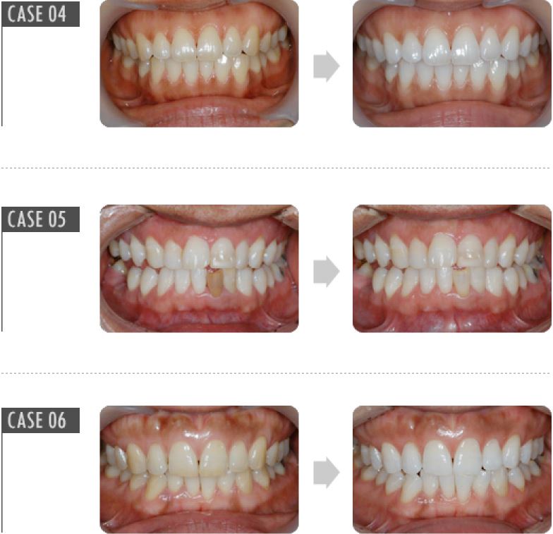 20200306_090848_5e6194900864d.jpg 20200306_090848_5e6194900864d.jpg